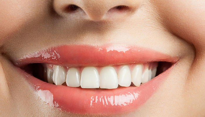 Hábitos considerados saludables que en realidad dañan tus dientes