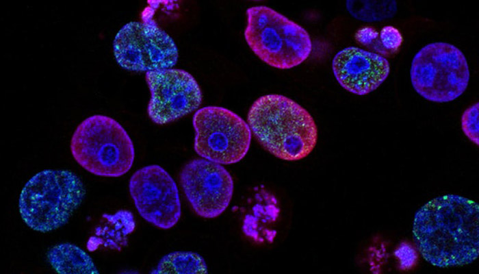 Identifican dos vías claves para la formación de células cancerosas